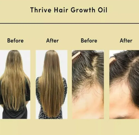 Crown Revival™  Hair Oil